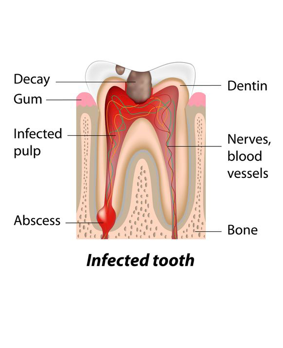 Endodontist Procedures