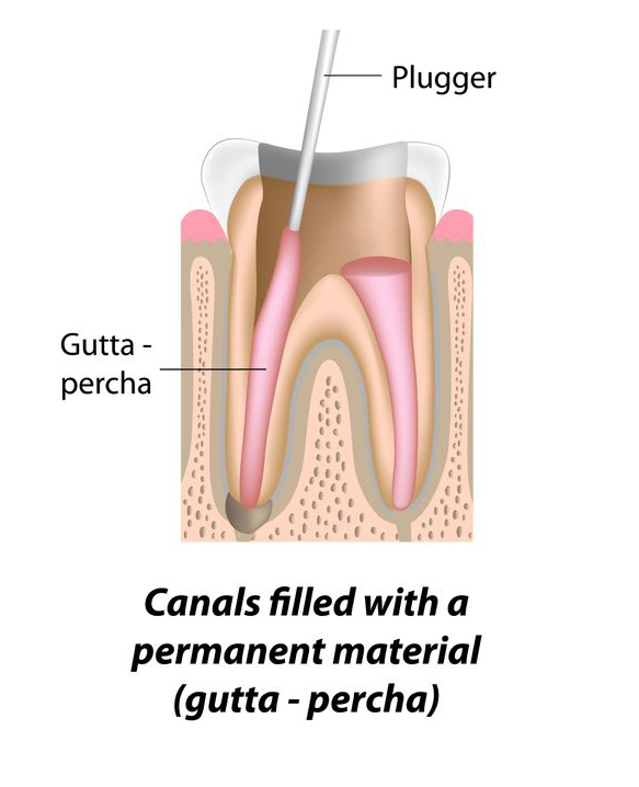 Endodontist Procedures