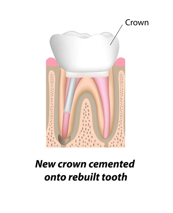 Endodontist Procedures